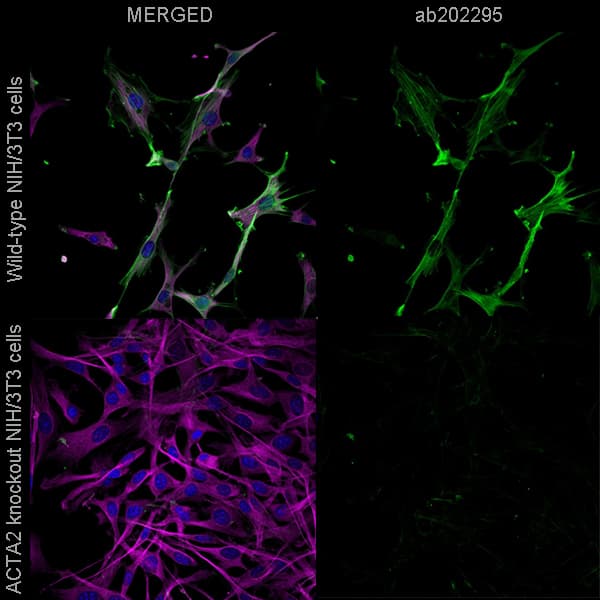 Alexa Fluor® 488 Anti-alpha smooth muscle Actin antibody [EPR5368](AB202295)