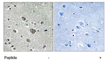 Zdhhc9 Antibody Ab74504  Immunohistochemistry Formalin Pfa Fixed Paraffin Embedded Sections Img19845