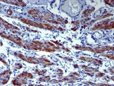 Anti-Caldesmon/CDM antibody [h-CALD](AB233987)
