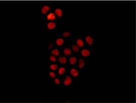 Anti-SOX9 antibody [EPR12755](AB182579)