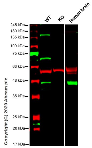 Anti-Synaptophysin antibody [EP1098Y] - BSA and Azide free(AB214621)