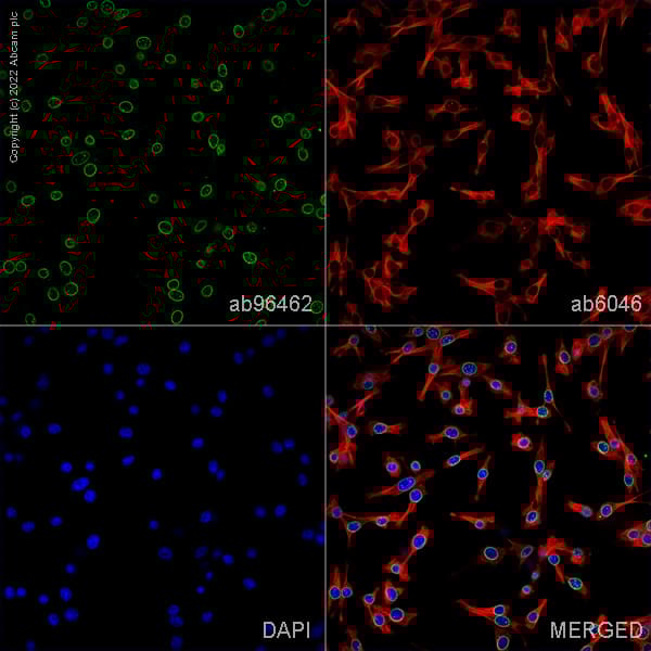 Anti-beta Tubulin antibody - Loading Control(AB6046)