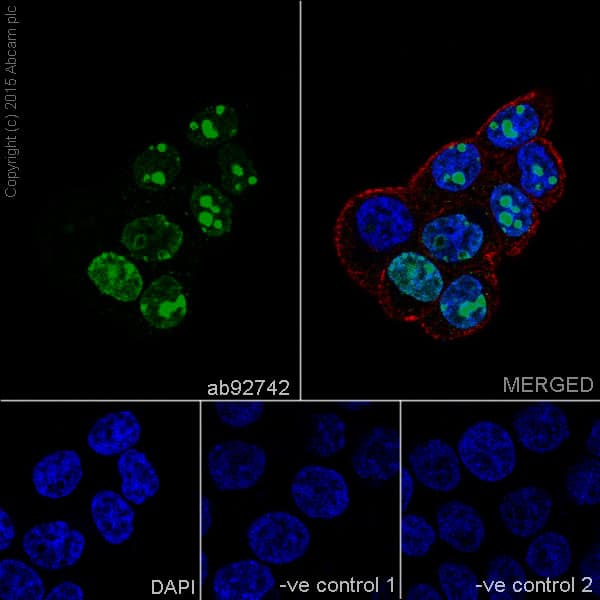 Anti-Ki67 antibody [EPR3610](AB92742)