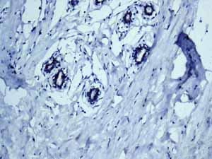 Cytochrome P450 4a Cyp4a11 Antibody Epr8276 Bsa And Azide Free Ab248918  Immunohistochemistry Formalin Pfa Fixed Paraffin Embedded Sections Img119415