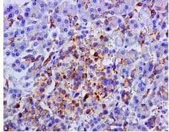 Aspartate Beta Hydroxylase Antibody Epr10351 Bsa And Azide Free Ab249694  Immunohistochemistry Formalin Pfa Fixed Paraffin Embedded Sections Img29137