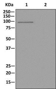 Aldh1l1 Aldh1l2 Antibody Epr12743b Astrocyte Marker Ab177463  Western Blot Img57197