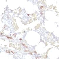 Anti-CD14 antibody [SP192](AB183322)