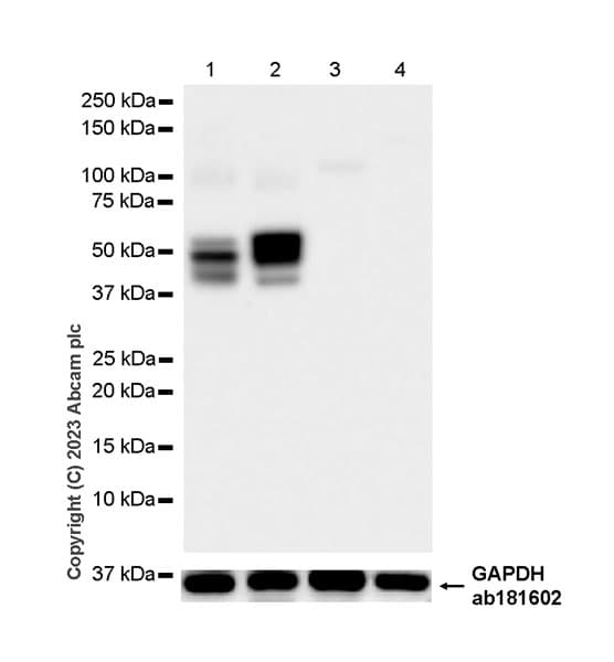 Pan Cytokeratin Antibody Epr28285 45 Bsa And Azide Free Ab308263  Western Blot Img408852