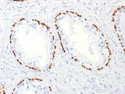 Anti-p63 antibody [TP63/2427](ab238079)