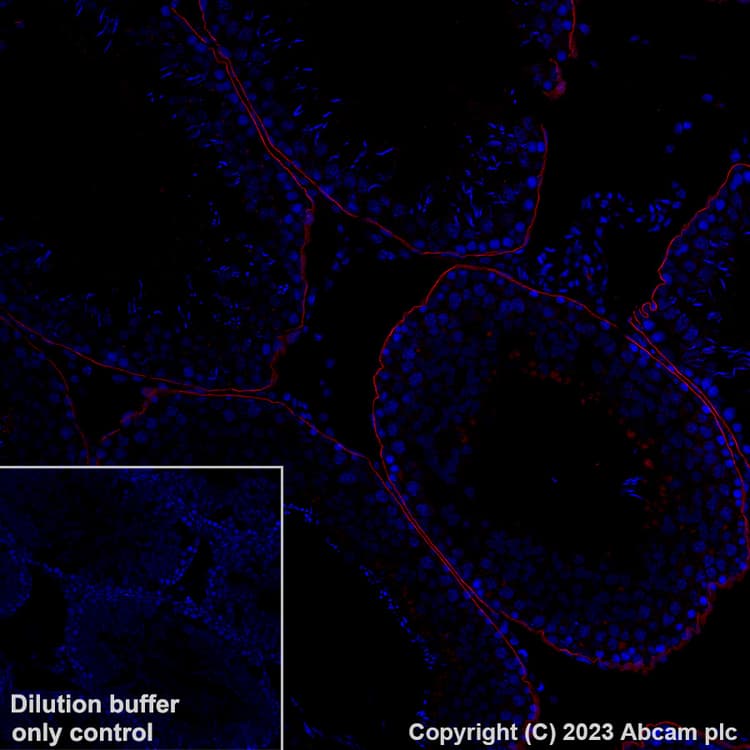 Alexa Fluor® 647 Anti-LAMA1 antibody [EPR27258-37](ab315852)