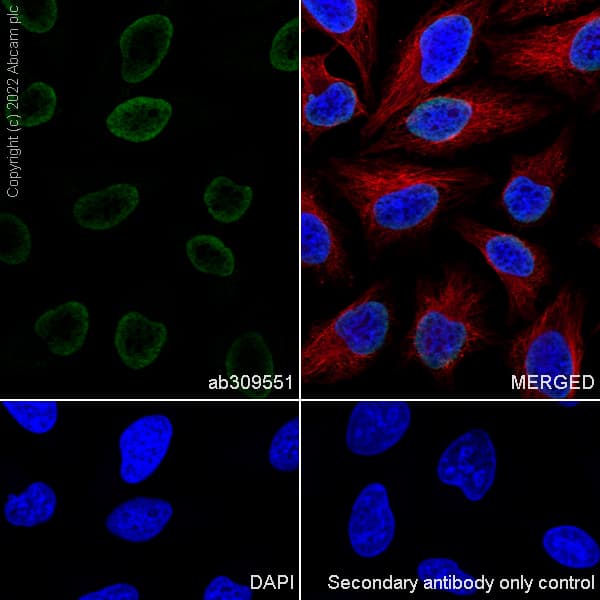 Goat Anti-Rat IgG H&L (Alexa Fluor® 488)(AB150157)