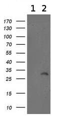 Anti-ITM2B antibody [OTI1C11](AB119044)