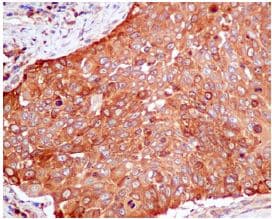 Pkm Antibody Epr10139 Ab154816  Immunohistochemistry Formalin Pfa Fixed Paraffin Embedded Sections Img87488