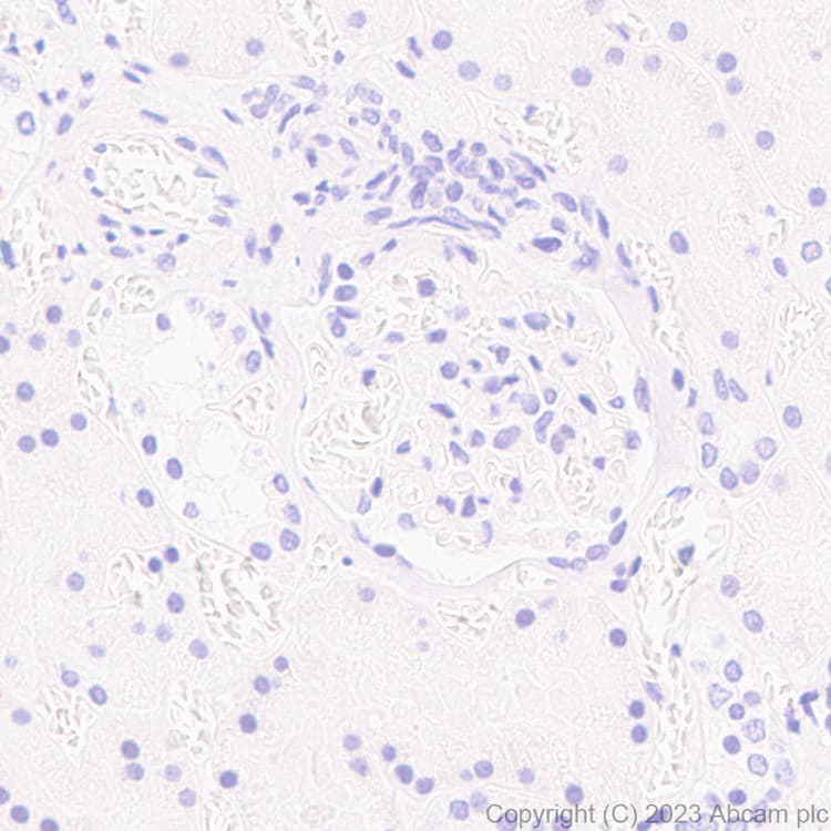 Anti-RFP antibody [EPR28246-45](AB314225)