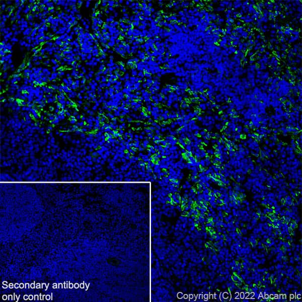 Anti-Mannose Receptor antibody [EPR25215-277](AB300621)