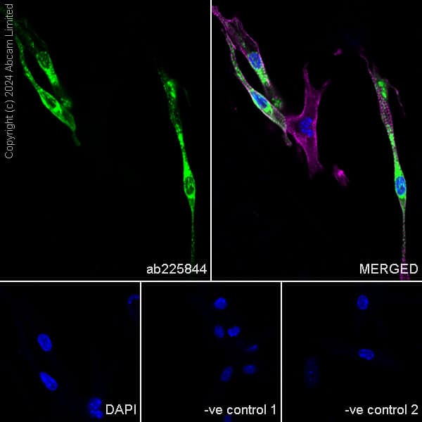 Anti-Sarcomeric Alpha Actinin antibody [EA-53](AB9465)