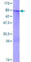 Recombinant Human Cytokeratin 7 protein(AB132933)