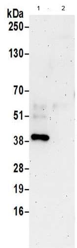 Anti-DHPS/DHS antibody(AB190266)