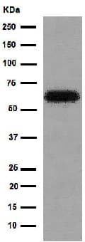 Anti-HAI-1 antibody [EPR15652](AB189511)