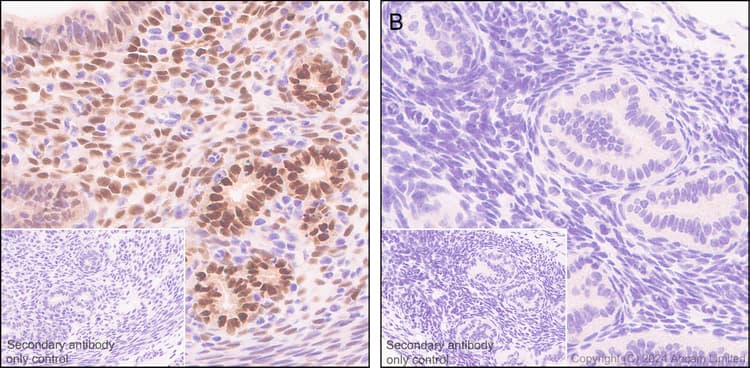 Anti-Estrogen Receptor alpha antibody [E115] - ChIP Grade(ab32063)