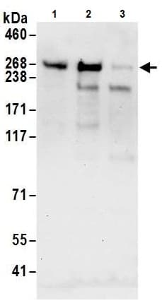 Anti-Tet2 antibody(AB245287)