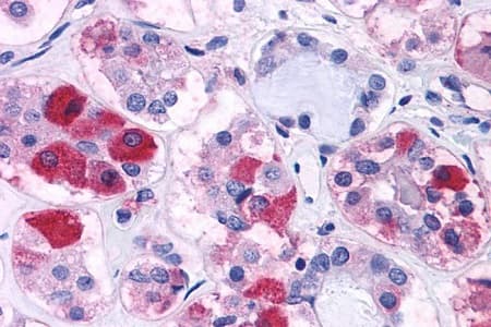 Anti-CRF1/CRHR1 antibody - N-terminal(AB230803)