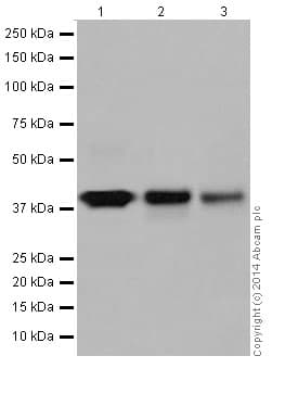 Anti-Glutamine Synthetase antibody [EPR16661](AB197024)