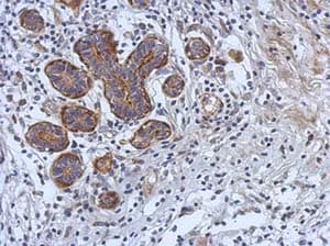 Cerk Antibody Ab155061  Immunohistochemistry Formalin Pfa Fixed Paraffin Embedded Sections Img133108