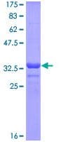 Recombinant Human intestinal alkaline phosphatase protein(AB114266)