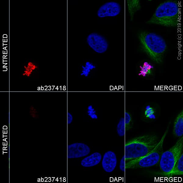 Alexa Fluor® 647 Anti-Histone H3 (phospho S28) antibody [E191](AB237418)