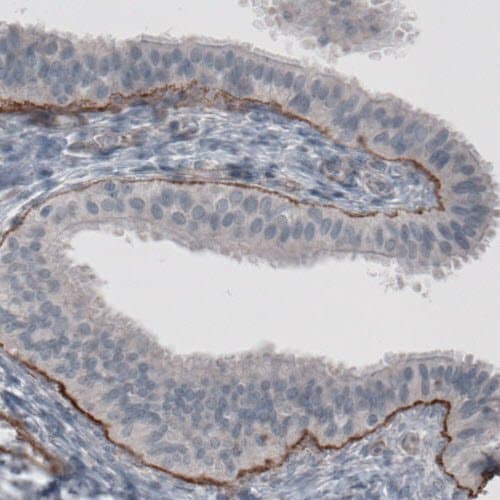 Anti-Laminin alpha 5/LAMA5 antibody [CL3118](AB210957)