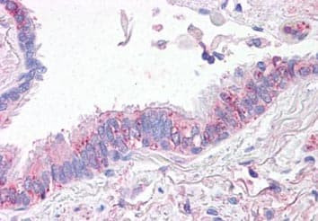 Slc31a1 Ctr1 Antibody Ab133385  Immunohistochemistry Formalin Pfa Fixed Paraffin Embedded Sections Img121190