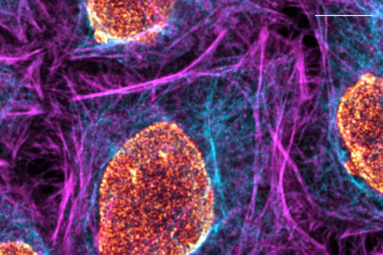 Multicolor Fixed Sample Confocal Kid21768045