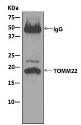 Anti-TOMM22/TOM22 antibody [EPR13505] - BSA and Azide free(AB250125)