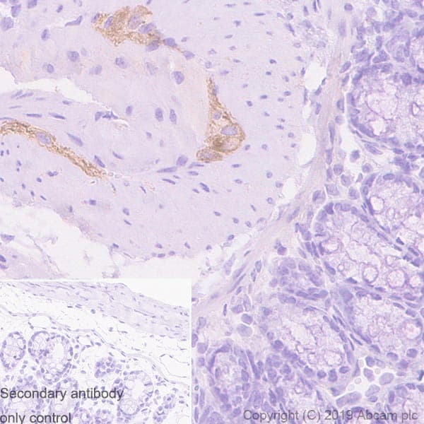 Anti-Peripherin antibody [EPR23445-28] - BSA and Azide free(AB269861)