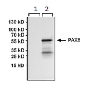 Anti-PAX8 antibody [1F8-3A8](AB183573)