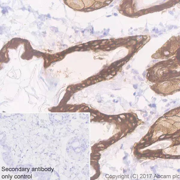 Anti-Cytokeratin 5 antibody [EP1601Y] - Cytoskeleton Marker(AB52635)