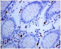 Ltk Antibody Epr51752 Ab129155  Immunohistochemistry Formalin Pfa Fixed Paraffin Embedded Sections Img84334