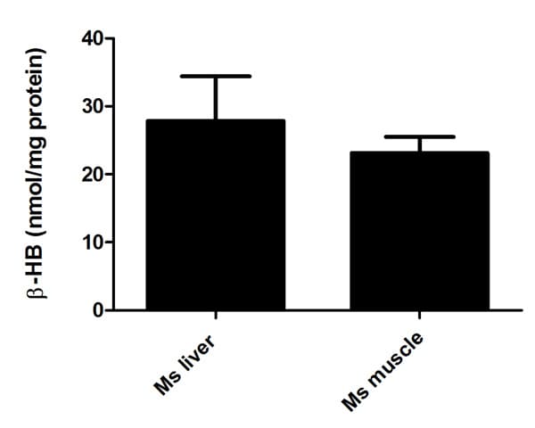 beta Hydroxybutyrate (beta HB) Assay Kit (Colorimetric)(ab83390)