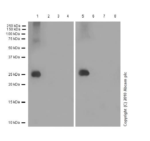 Snap25 Antibody Ep3274 Ab108990  Western Blot Img1068