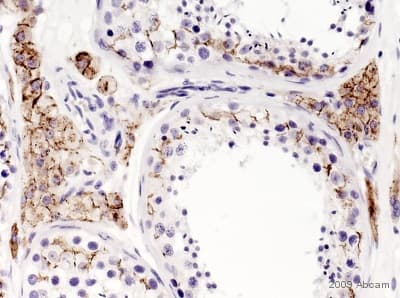 Anti-Connexin 43 / GJA1 antibody - Intercellular Junction Marker(AB11370)