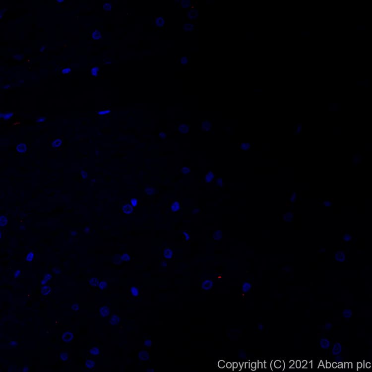 Alexa Fluor 555 Lamp2a Antibody Epr42072 Lysosome Marker Ab282009  Immunohistochemistry Formalin Pfa Fixed Paraffin Embedded Sections Img166411