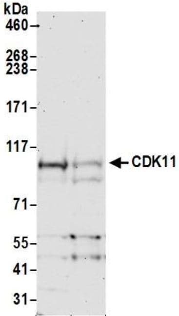 Cdk11 Cdc2l2 Cdk11a Antibody Ab19393  Western Blot Img176458