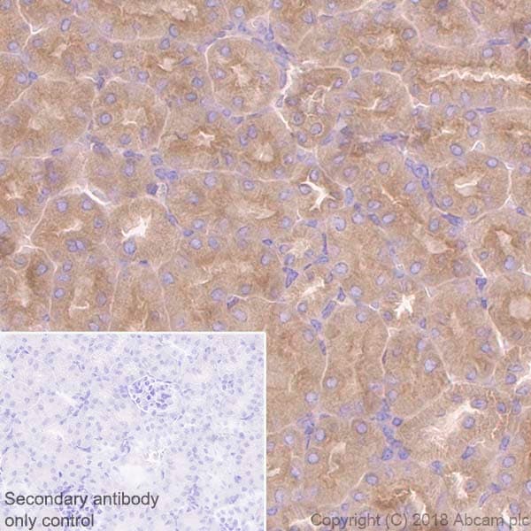 Anti-Rab5 antibody [EPR21801] - Early Endosome Marker(AB218624)