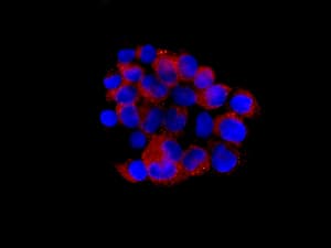 Ceruloplasmin Antibody Epsisr6 42 Ab157452  Immunocytochemistry Immunofluorescence Img961