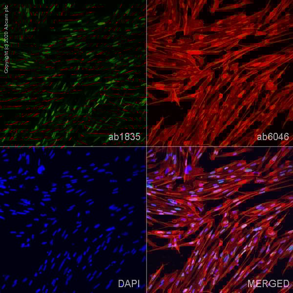 Anti-Myogenin antibody [F5D](AB1835)