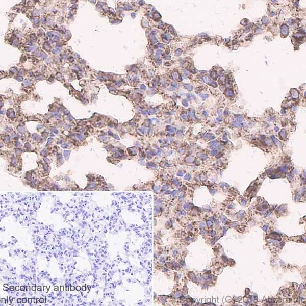 Anti-Calreticulin antibody [EPR3924] - ER Marker(AB92516)