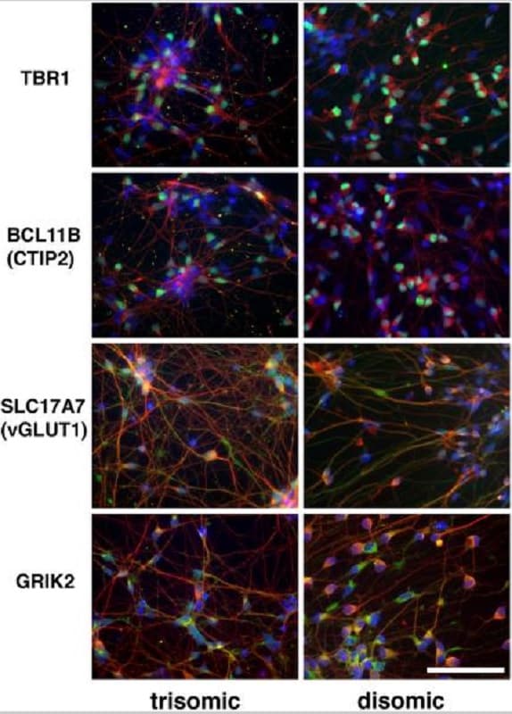 Anti-beta III Tubulin antibody [TU-20] - Neuronal Marker(ab7751)