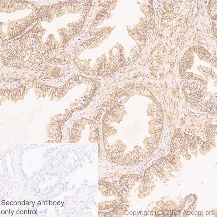 Anti-NF-kB p65 antibody [E379](AB32536)