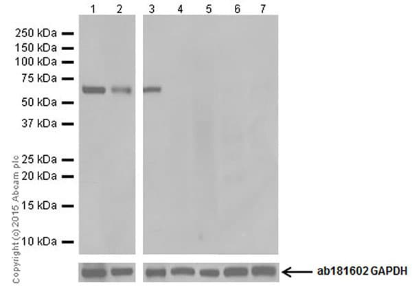 Bace1 Antibody Epr19523 Ab183612  Western Blot Img34366